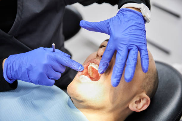 Best Dentist for Tooth Abscess  in Mountain Lakes, NJ